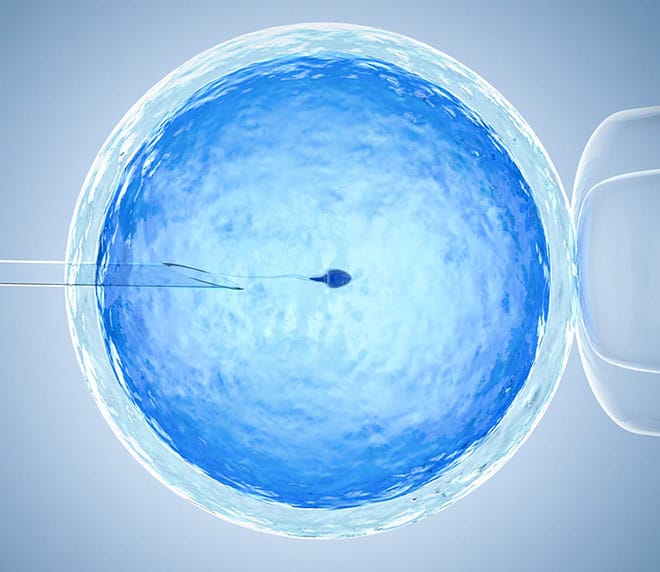 Sperm Donor Screening Overview