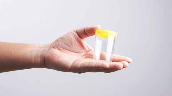semen analysis man holding small clear specimen cup with yellow lid in left hand